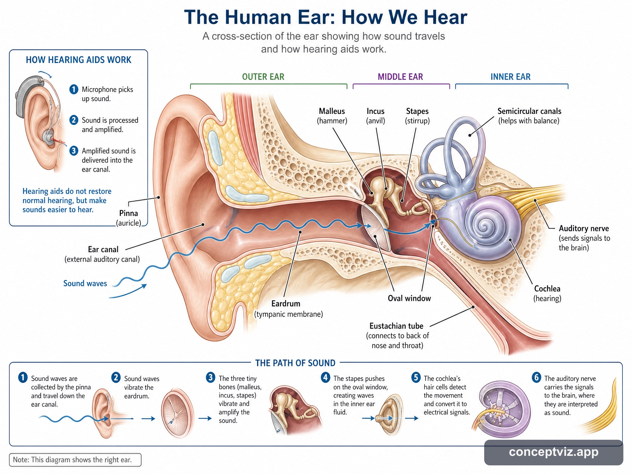 How Hearing Aids Deliver and Amplify Sound in the Human Ear